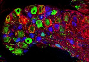 A bundle of nerves that relays information from touch receptors on the skin to the spinal cord and ultimately the brain, imaged with the new technique