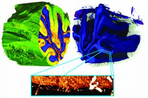 Three-dimensional false-colour renderings of a human cerebellum, obtained with X-ray grating interferometric phase-contrast tomography.