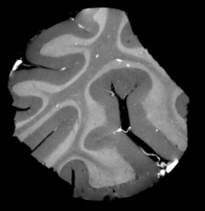 A single tomographic slice from the phase-contrast tomography dataset.